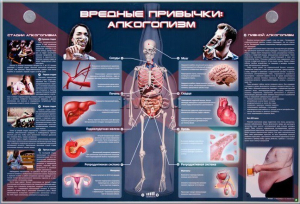 Электрифицированный стенд "Вредные привычки: алкоголизм" - fgospostavki.ru - Белогорск